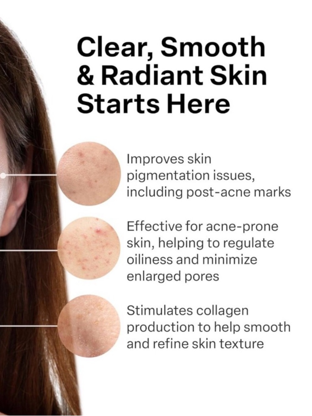 FRENCH PHARM A313 Vitamin A Pommade + Ialuset Hyaluronic Acid Cream Anti Wrinkle - Picture 3 of 9